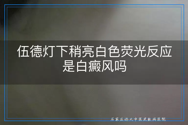 伍德灯下稍亮白色荧光反应是白癜风吗
