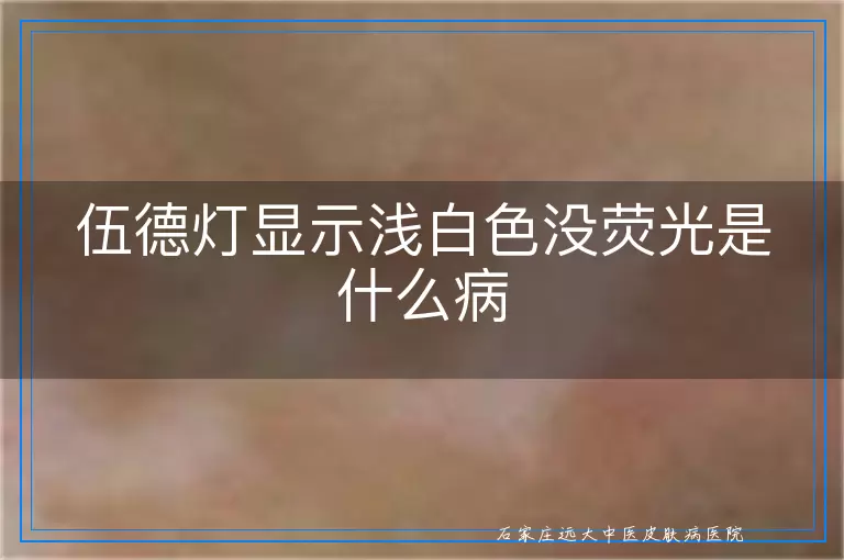 伍德灯显示浅白色没荧光是什么病