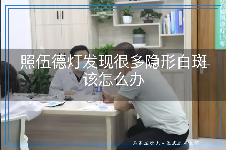 照伍德灯发现很多隐形白斑该怎么办
