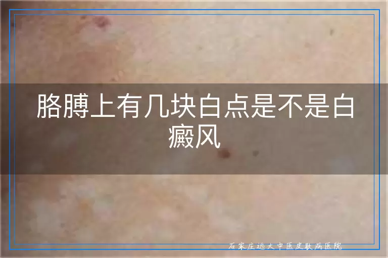胳膊上有几块白点是不是白癜风
