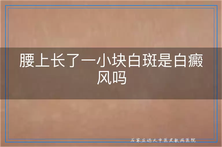 腰上长了一小块白斑是白癜风吗