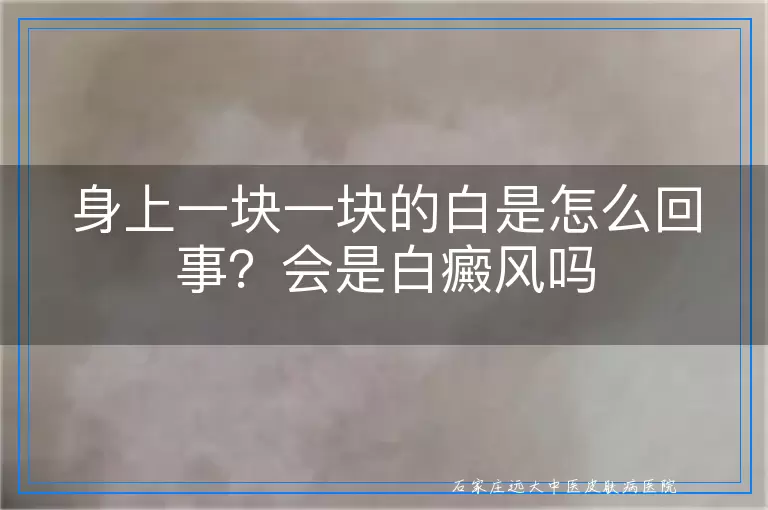 身上一块一块的白是怎么回事?会是白癜风吗