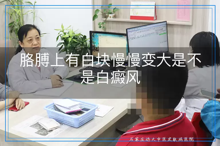 胳膊上有白块慢慢变大是不是白癜风