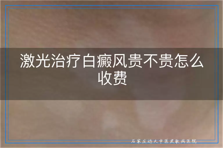 激光治疗白癜风贵不贵怎么收费