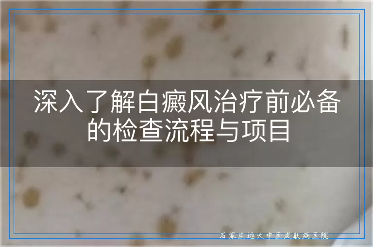 深入了解白癜风治疗前必备的检查流程与项目