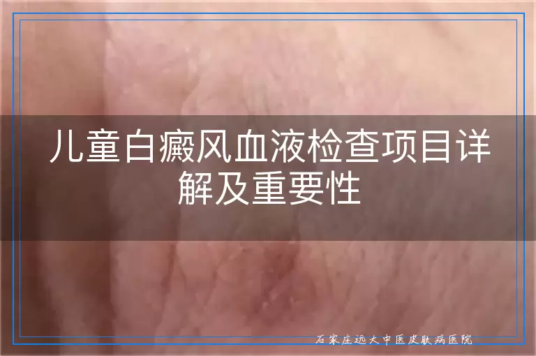 儿童白癜风血液检查项目详解及重要性