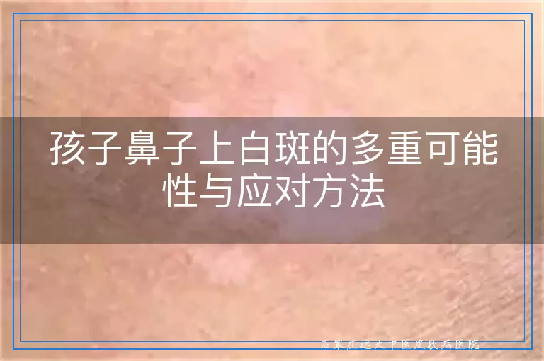 孩子鼻子上白斑的多重可能性与应对方法
