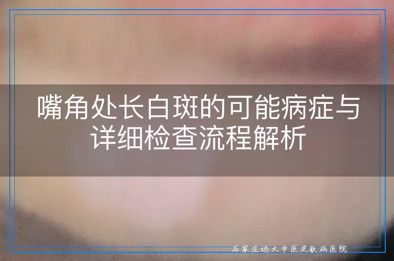 嘴角处长白斑的可能病症与详细检查流程解析