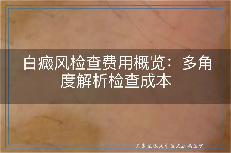 白癜风检查费用概览：多角度解析检查成本