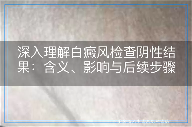 深入理解白癜风检查阴性结果：含义、影响与后续步骤