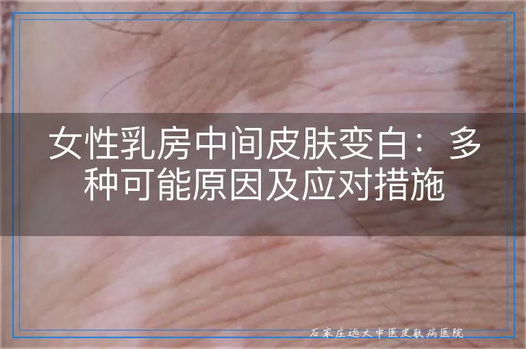 女性乳房中间皮肤变白：多种可能原因及应对措施