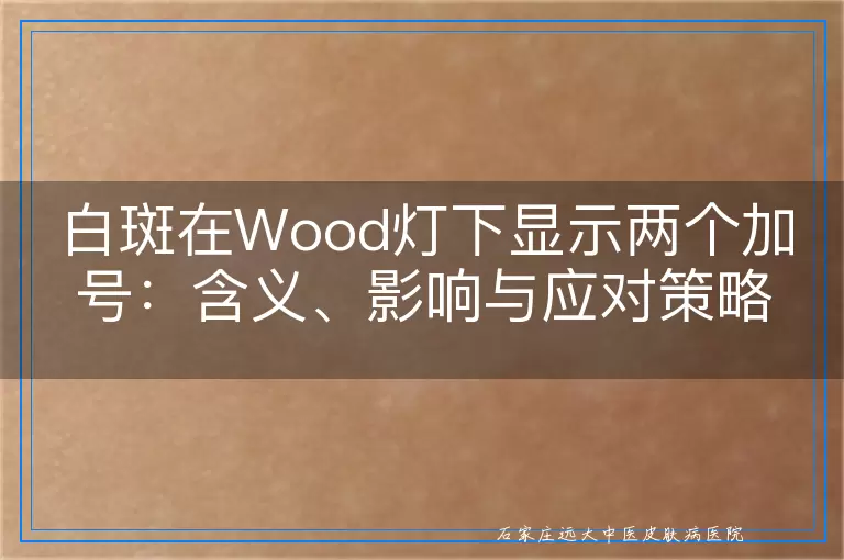 白斑在Wood灯下显示两个加号：含义、影响与应对策略