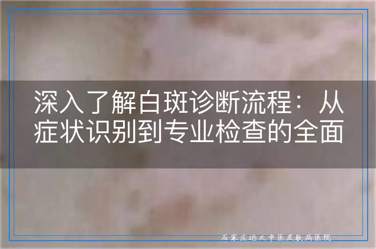 深入了解白斑诊断流程：从症状识别到专业检查的全面指引