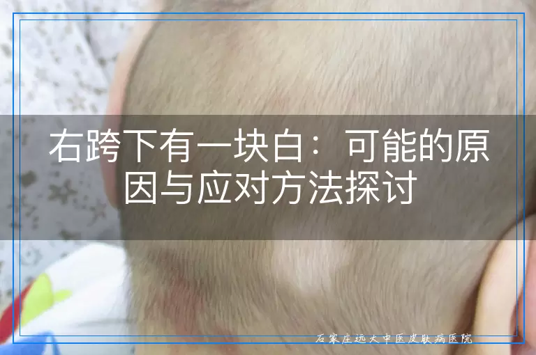 右跨下有一块白：可能的原因与应对方法探讨