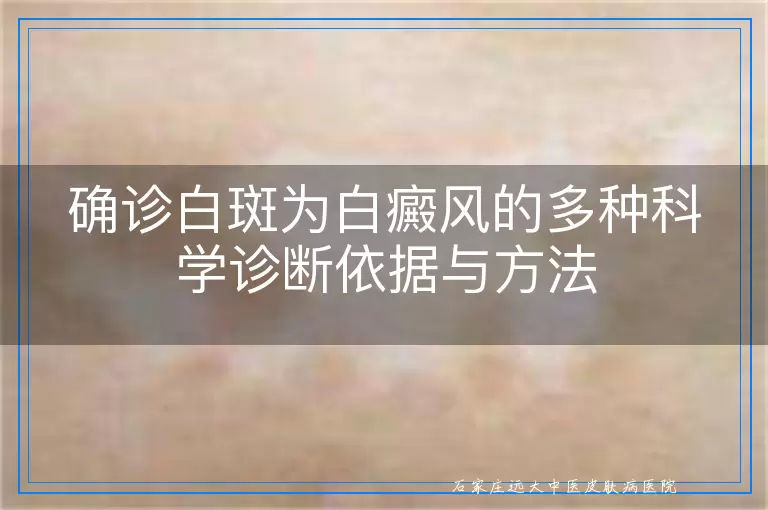 确诊白斑为白癜风的多种科学诊断依据与方法