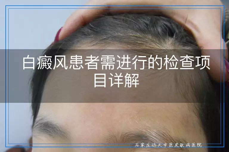 白癜风患者需进行的检查项目详解