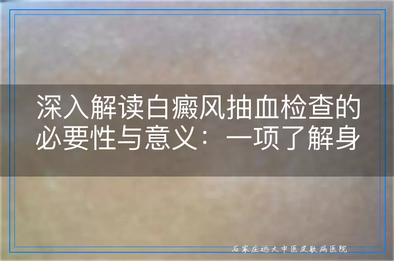 深入解读白癜风抽血检查的必要性与意义：一项了解身体内在状况的窗口