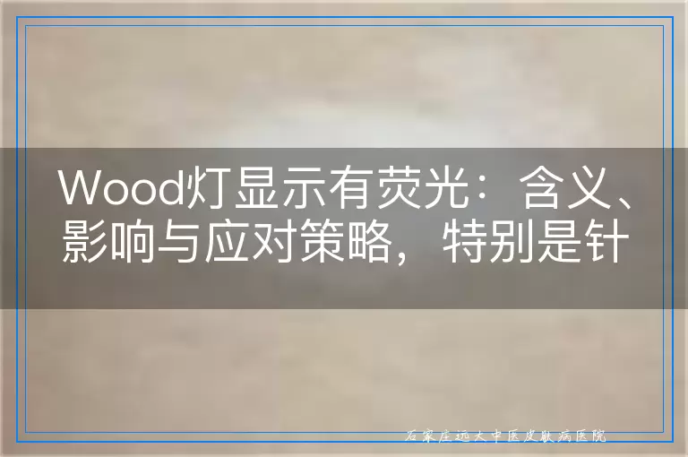 Wood灯显示有荧光：含义、影响与应对策略，特别是针对白癜风与白斑的考量