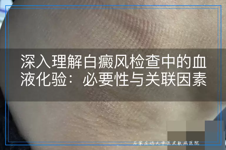 深入理解白癜风检查中的血液化验：必要性与关联因素剖析