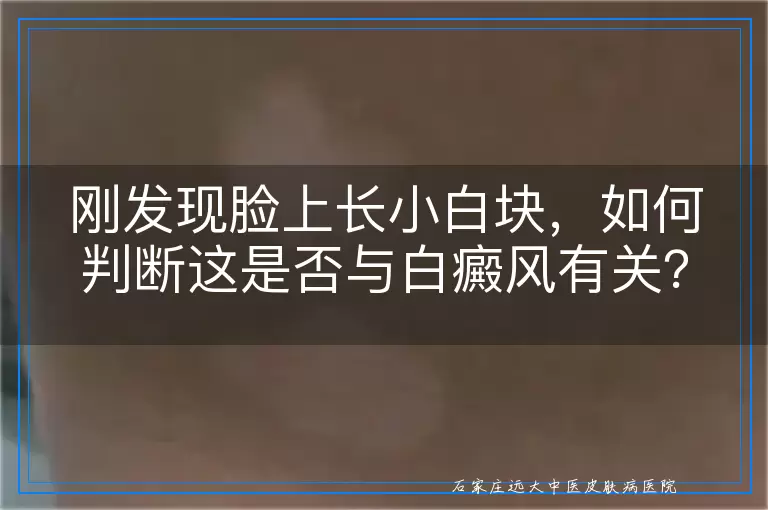 刚发现脸上长小白块，如何判断这是否与白癜风有关？