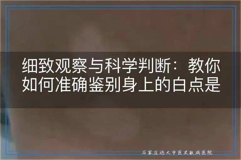 细致观察与科学判断：教你如何准确鉴别身上的白点是否为白癜风