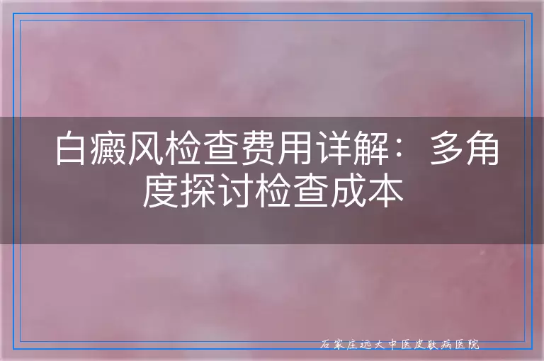 白癜风检查费用详解：多角度探讨检查成本