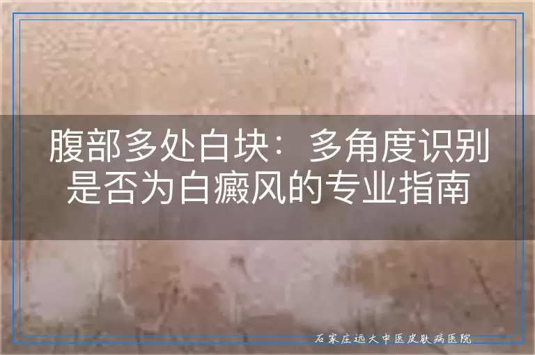 腹部多处白块：多角度识别是否为白癜风的专业指南