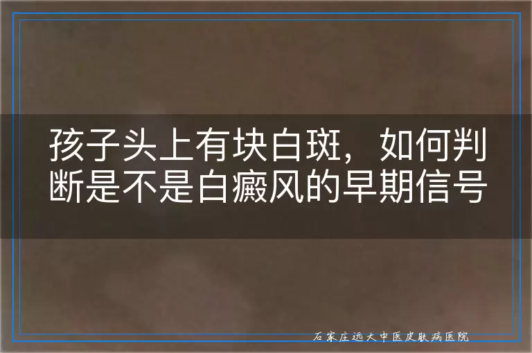 孩子头上有块白斑，如何判断是不是白癜风的早期信号？