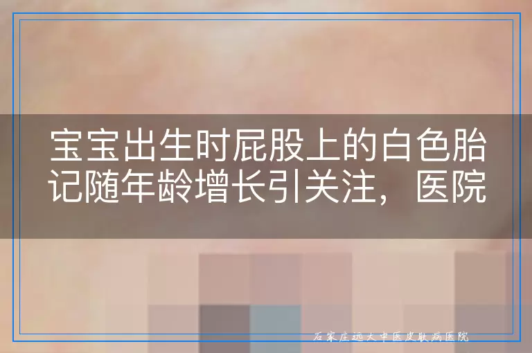 宝宝出生时屁股上的白色胎记随年龄增长引关注，医院诊断非白癜风：这真的是胎记吗？