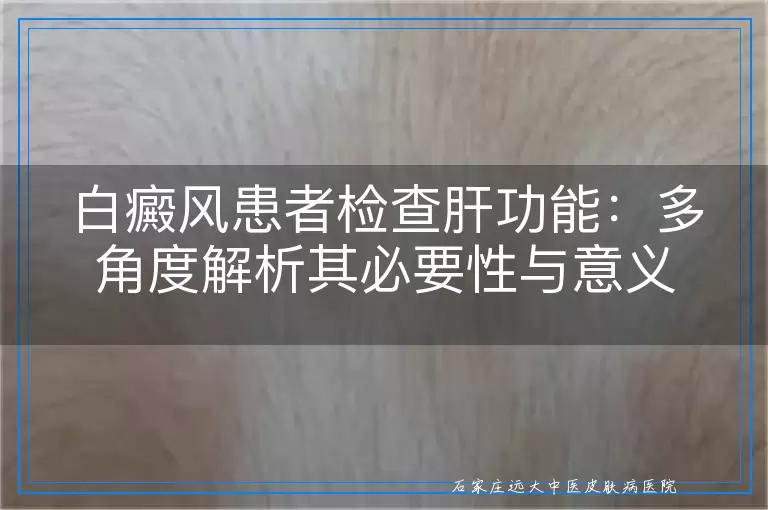 白癜风患者检查肝功能：多角度解析其必要性与意义