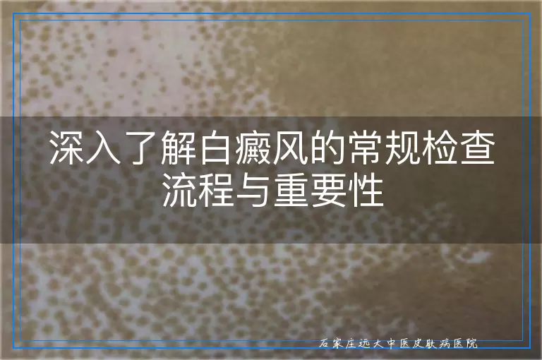 深入了解白癜风的常规检查流程与重要性