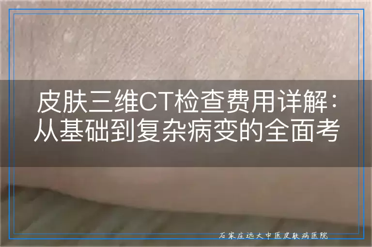 皮肤三维CT检查费用详解：从基础到复杂病变的全面考量
