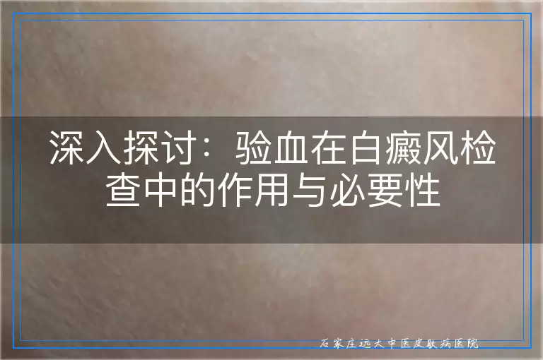 深入探讨：验血在白癜风检查中的作用与必要性
