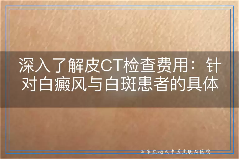 深入了解皮CT检查费用：针对白癜风与白斑患者的具体花费指南