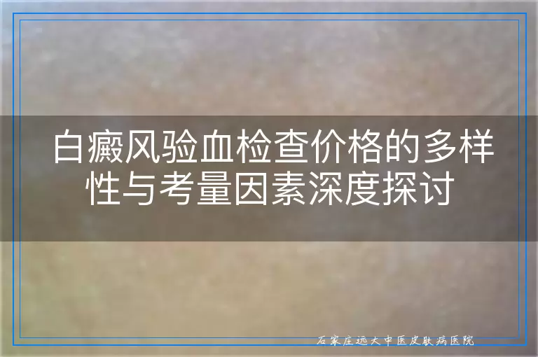 白癜风验血检查价格的多样性与考量因素深度探讨