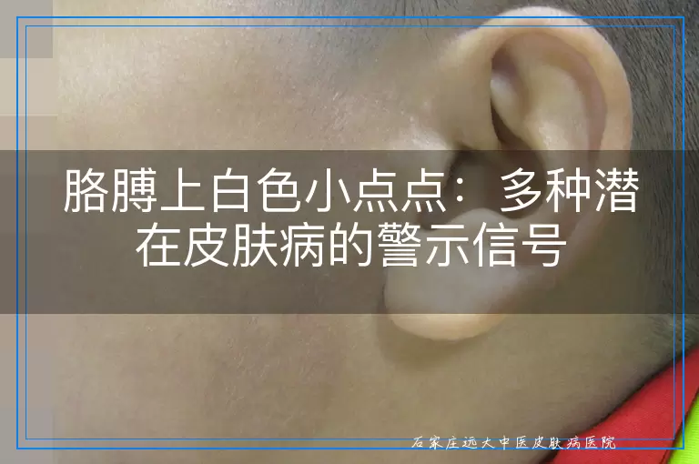 胳膊上白色小点点：多种潜在皮肤病的警示信号
