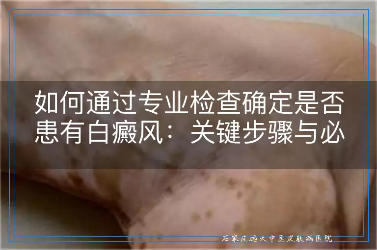 如何通过专业检查确定是否患有白癜风：关键步骤与必查项目详解