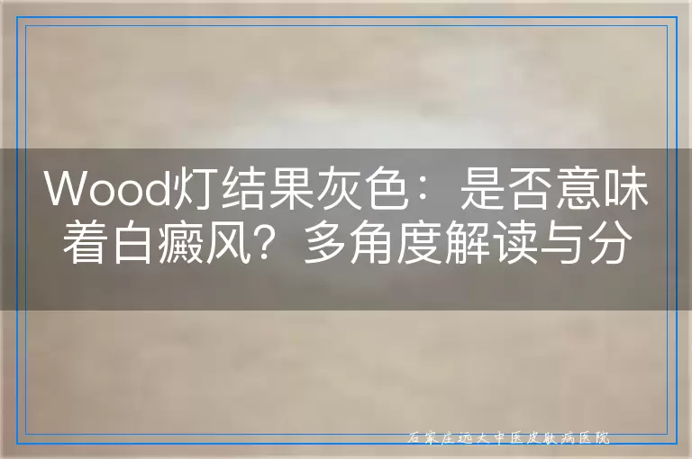 Wood灯结果灰色：是否意味着白癜风？多角度解读与分析