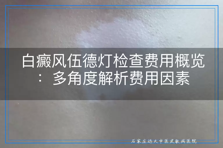 白癜风伍德灯检查费用概览：多角度解析费用因素
