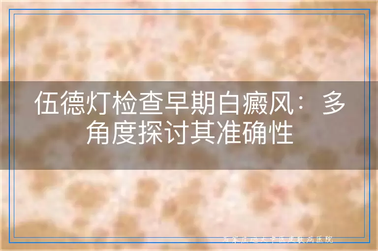 伍德灯检查早期白癜风：多角度探讨其准确性