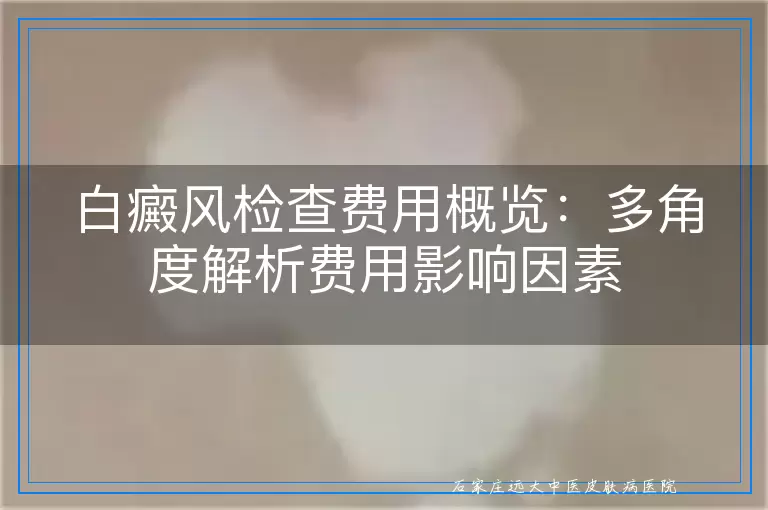 白癜风检查费用概览：多角度解析费用影响因素