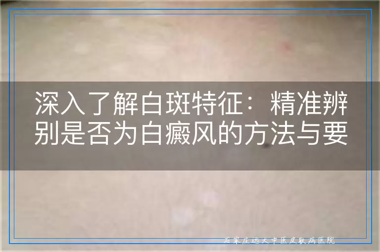 深入了解白斑特征：精准辨别是否为白癜风的方法与要点