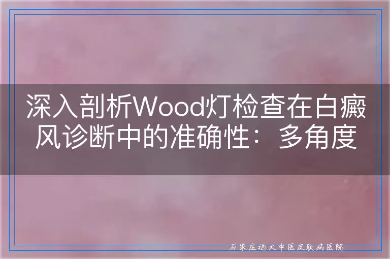 深入剖析Wood灯检查在白癜风诊断中的准确性：多角度审视