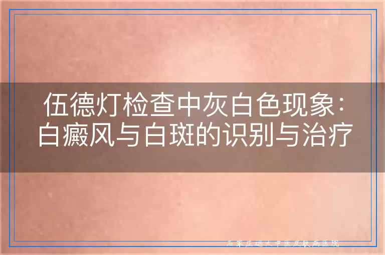 伍德灯检查中灰白色现象：白癜风与白斑的识别与治疗指南