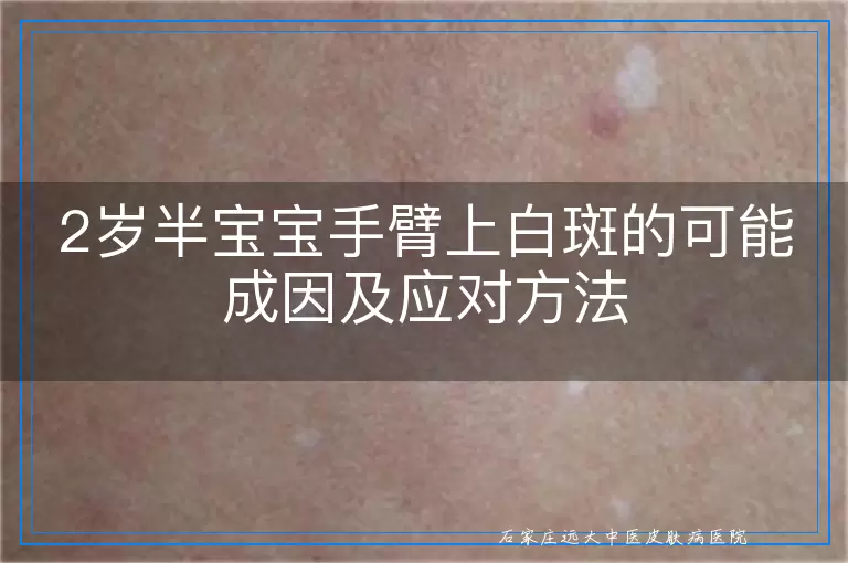 2岁半宝宝手臂上白斑的可能成因及应对方法