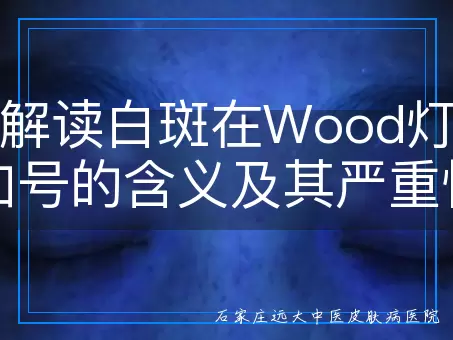 深入解读白斑在Wood灯下两个加号的含义及其严重性评估