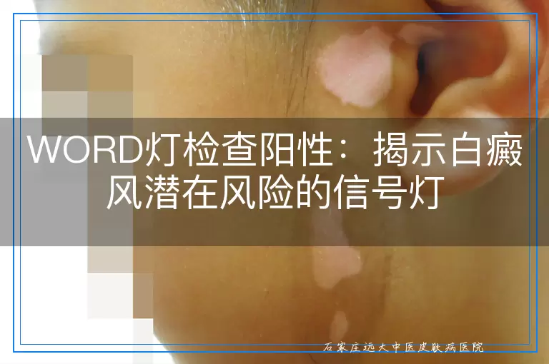 WORD灯检查阳性：揭示白癜风潜在风险的信号灯