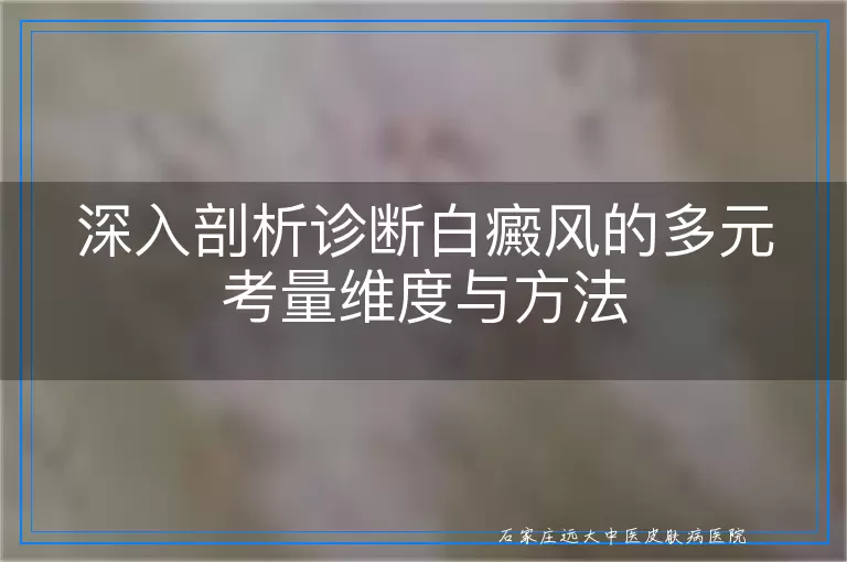 深入剖析诊断白癜风的多元考量维度与方法