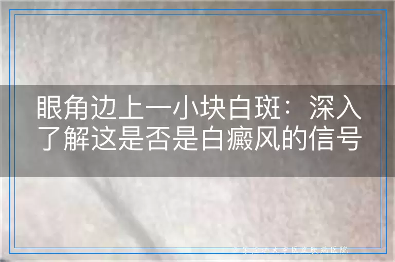 眼角边上一小块白斑：深入了解这是否是白癜风的信号