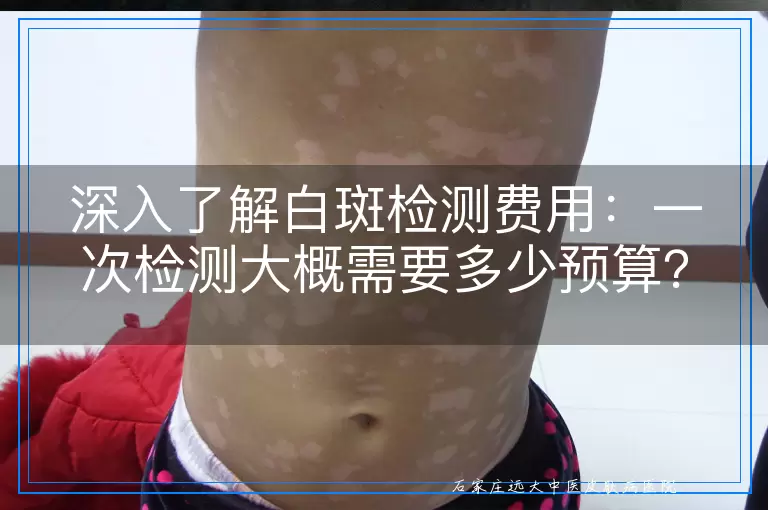 深入了解白斑检测费用：一次检测大概需要多少预算？